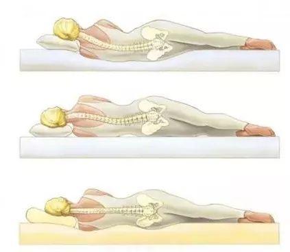 腰椎间盘突出最新治疗方法,科技重塑康复之路