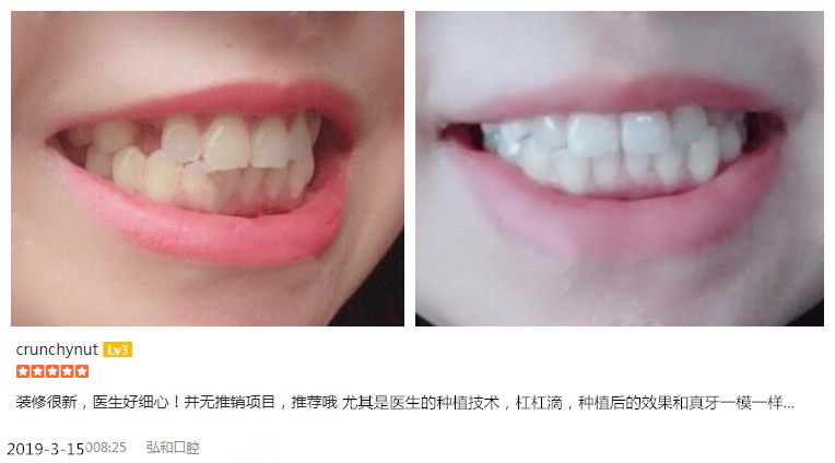 探索未来口腔健康新方向,牙齿矫正的新趋势与未来展望