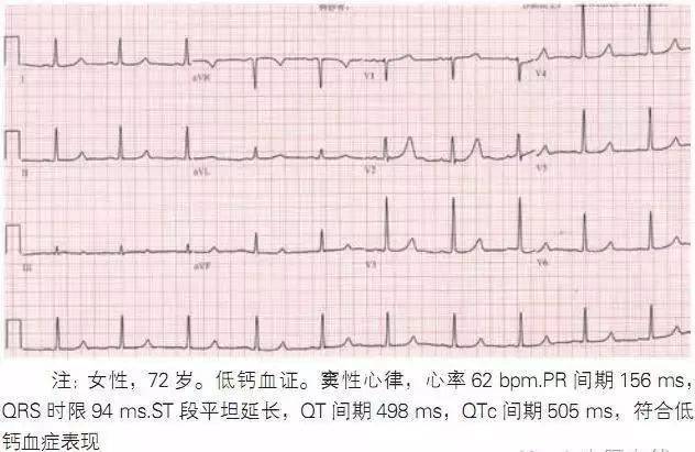 心电图最新资讯,小巷深处的医学宝藏
